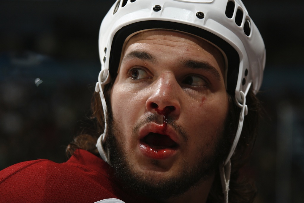 Getty Carcillo Daniel Carcillo kärsi NHL-urallaan aivotärähdyksistä.