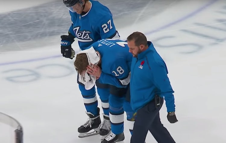 Bryan Little aivovamma Bryan Little sai toissa yönä kiekon päähänsä.